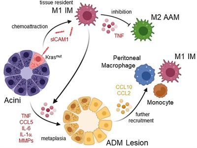 Roles of differently polarized macrophages in the initiation and progressionof pancreatic cancer